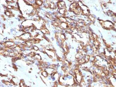Immunohistochemistry-Paraffin: Vimentin Antibody (VM1170) - Azide and BSA Free [NBP2-47950]