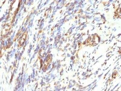 Immunohistochemistry-Paraffin: Vimentin Antibody (VM1170) - Azide and BSA Free [NBP2-47950]