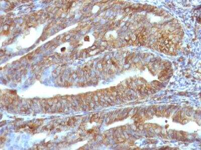 Immunohistochemistry-Paraffin: Vimentin Antibody (VM1170) - Azide and BSA Free [NBP2-47950]