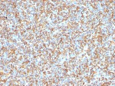 Immunohistochemistry-Paraffin: Vimentin Antibody (VM1170) - Azide and BSA Free [NBP2-47950]