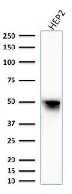 Western Blot: Vimentin Antibody (VM1170)Azide and BSA Free [NBP2-47950]