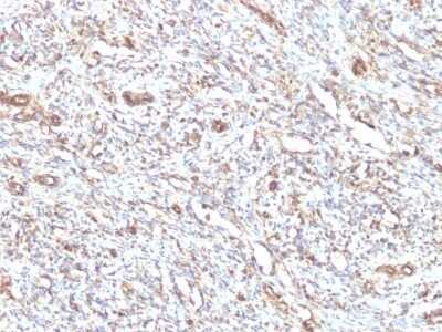 Immunohistochemistry-Paraffin: Vimentin Antibody (VM1170) - IHC-Prediluted [NBP2-48191]