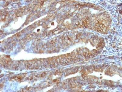 Immunohistochemistry-Paraffin: Vimentin Antibody (VM1170) - IHC-Prediluted [NBP2-48191]