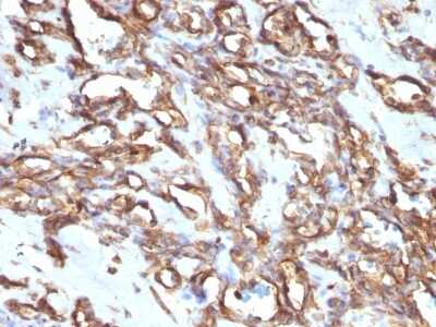 Immunohistochemistry-Paraffin: Vimentin Antibody (VM1170) [NBP2-44833]