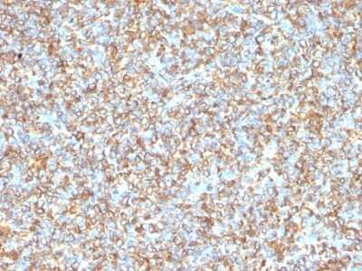 Immunohistochemistry-Paraffin: Vimentin Antibody (VM1170) [NBP2-44833]