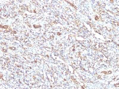 Immunohistochemistry-Paraffin: Vimentin Antibody (VM1170) [NBP2-44833]