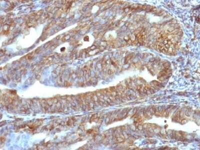 Immunohistochemistry-Paraffin: Vimentin Antibody (VM1170) [NBP2-44833]