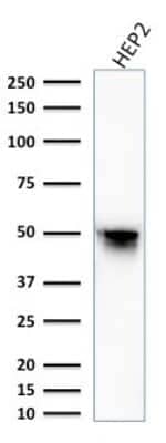 Western Blot: Vimentin Antibody (VM1170) [NBP2-44833]