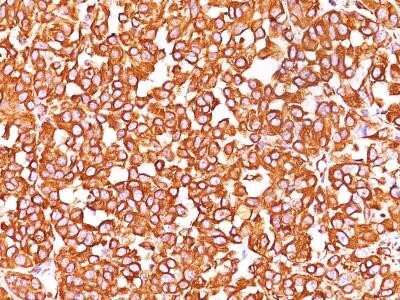 Immunohistochemistry-Paraffin: Vimentin Antibody (VM452) - Azide and BSA Free [NBP2-33060]