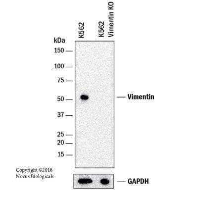 Knockout Validated: Vimentin Antibody (VM452) - Azide and BSA Free [NBP2-33060]