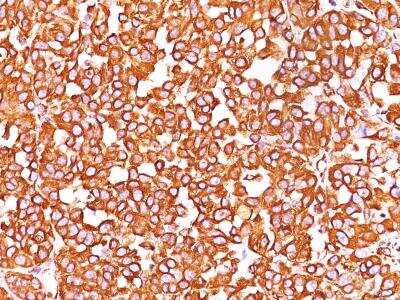 Immunohistochemistry-Paraffin: Vimentin Antibody (VM452) [NBP2-29433]