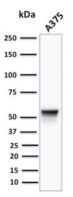 Western Blot: Vimentin Antibody (VM452) [NBP2-29433]