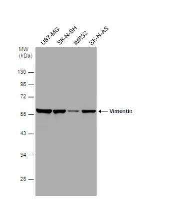 Western Blot: Vimentin Antibody [NBP1-31327]