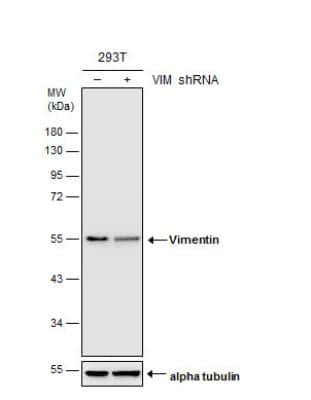 Knockdown Validated: Vimentin Antibody [NBP1-31327]