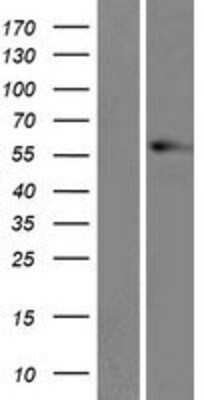 Western Blot: Vimentin Overexpression Lysate [NBP2-04249]