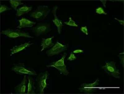 Immunocytochemistry/ Immunofluorescence: Vinculin Antibody (3F8-1D4) [H00007414-M02]