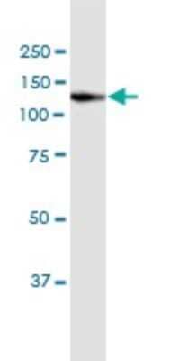 Western Blot: Vinculin Antibody (3F8-1D4) [H00007414-M02]