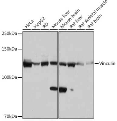 Western Blot: Vinculin Antibody (9I3Y8) [NBP3-16145]