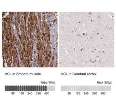 Immunohistochemistry-Paraffin: Vinculin Antibody [NBP1-87495]