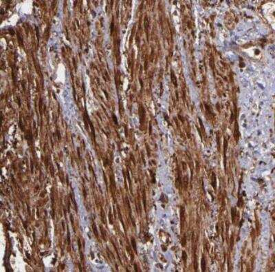 Immunohistochemistry-Paraffin: Vinculin Antibody [NBP1-87495]