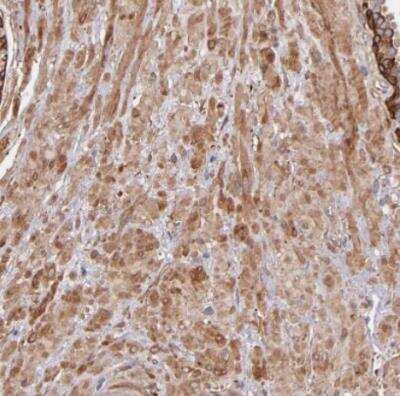 Immunohistochemistry-Paraffin: Vinculin Antibody [NBP1-87495]