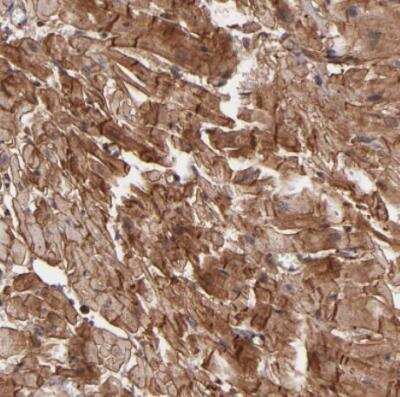 Immunohistochemistry-Paraffin: Vinculin Antibody [NBP1-87495]