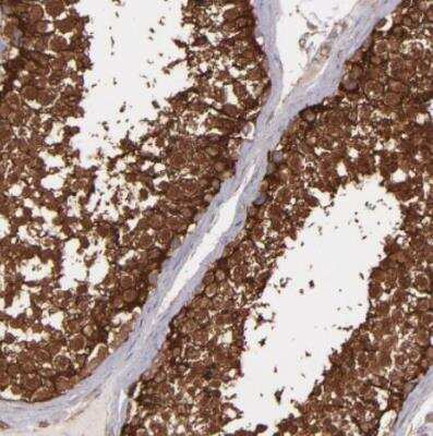 Immunohistochemistry-Paraffin: Vinculin Antibody [NBP1-87495]