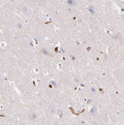 Immunohistochemistry-Paraffin: Vinculin Antibody [NBP1-87495]