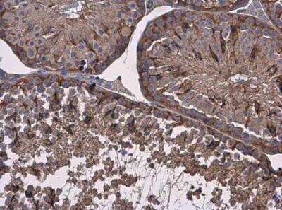 Immunohistochemistry-Paraffin: Vinculin Antibody [NBP2-20859]