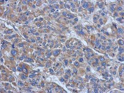 Vinculin Antibody - BSA Free (NBP2-20859) by Novus, Part of