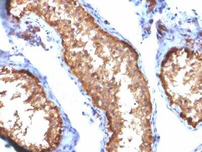 Immunohistochemistry-Paraffin: Vinculin Antibody (VCL/2572) - Azide and BSA Free [NBP2-79940]