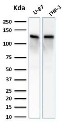 Western Blot: Vinculin Antibody (VCL/2572) [NBP2-79806]