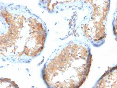 Immunohistochemistry-Paraffin: Vinculin Antibody (VCL/2573) - Azide and BSA Free [NBP2-79941]