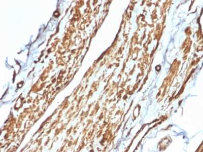 Immunohistochemistry-Paraffin: Vinculin Antibody (VCL/2575) [NBP2-79808]
