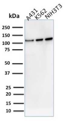 Western Blot: Vinculin Antibody (VCL/2575) [NBP2-79808]