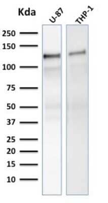 Western Blot: Vinculin Antibody (VCL/2575) [NBP2-79808]