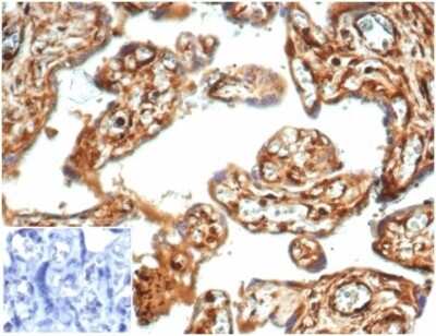 Immunohistochemistry-Paraffin: Vinculin Antibody (VCL/7091R) [NBP3-13989]