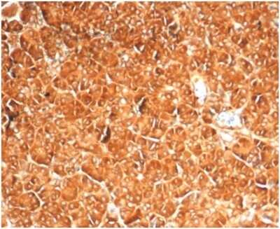 Immunohistochemistry-Paraffin: Vinculin Antibody (VCL/7091R) [NBP3-13989]