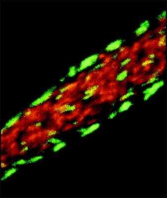 Immunocytochemistry/ Immunofluorescence: Vinculin Antibody (VIN-11-5) [NB120-11193]