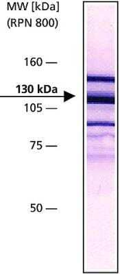 Western Blot: Vinculin Antibody (VIN-11-5) [NB120-11193]