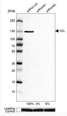 Western Blot: Vinculin Antibody [NBP1-87495]