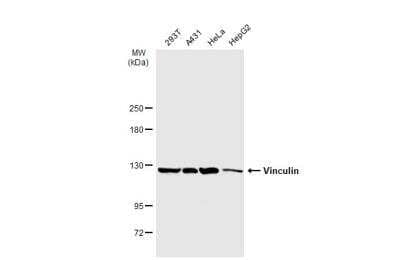 Western Blot: Vinculin Antibody [NBP2-20859]