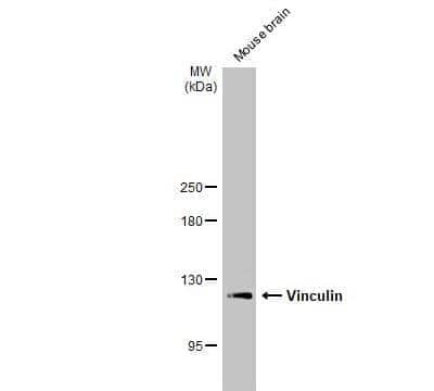 Western Blot: Vinculin Antibody [NBP2-20859]