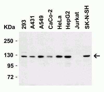 Western Blot: Vinculin AntibodyBSA Free [NBP2-41237]