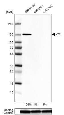 Western Blot: Vinculin Antibody [NBP2-55796]