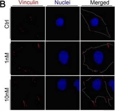 Immunocytochemistry/ Immunofluorescence: Vinculin Antibody (hVIN-1) [NB600-1293]