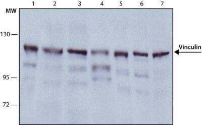 Western Blot: Vinculin Antibody (hVIN-1) [NB600-1293]