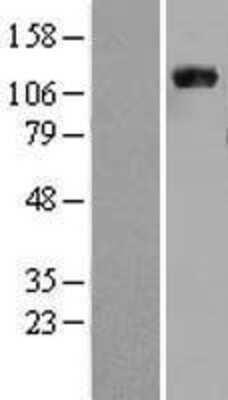 Western Blot: Vinculin Overexpression Lysate [NBL1-17706]