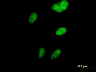 Immunocytochemistry/ Immunofluorescence: Vinexin Antibody [H00010174-B01P]