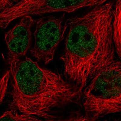 Immunocytochemistry/ Immunofluorescence: Vinexin Antibody [NBP2-56623]